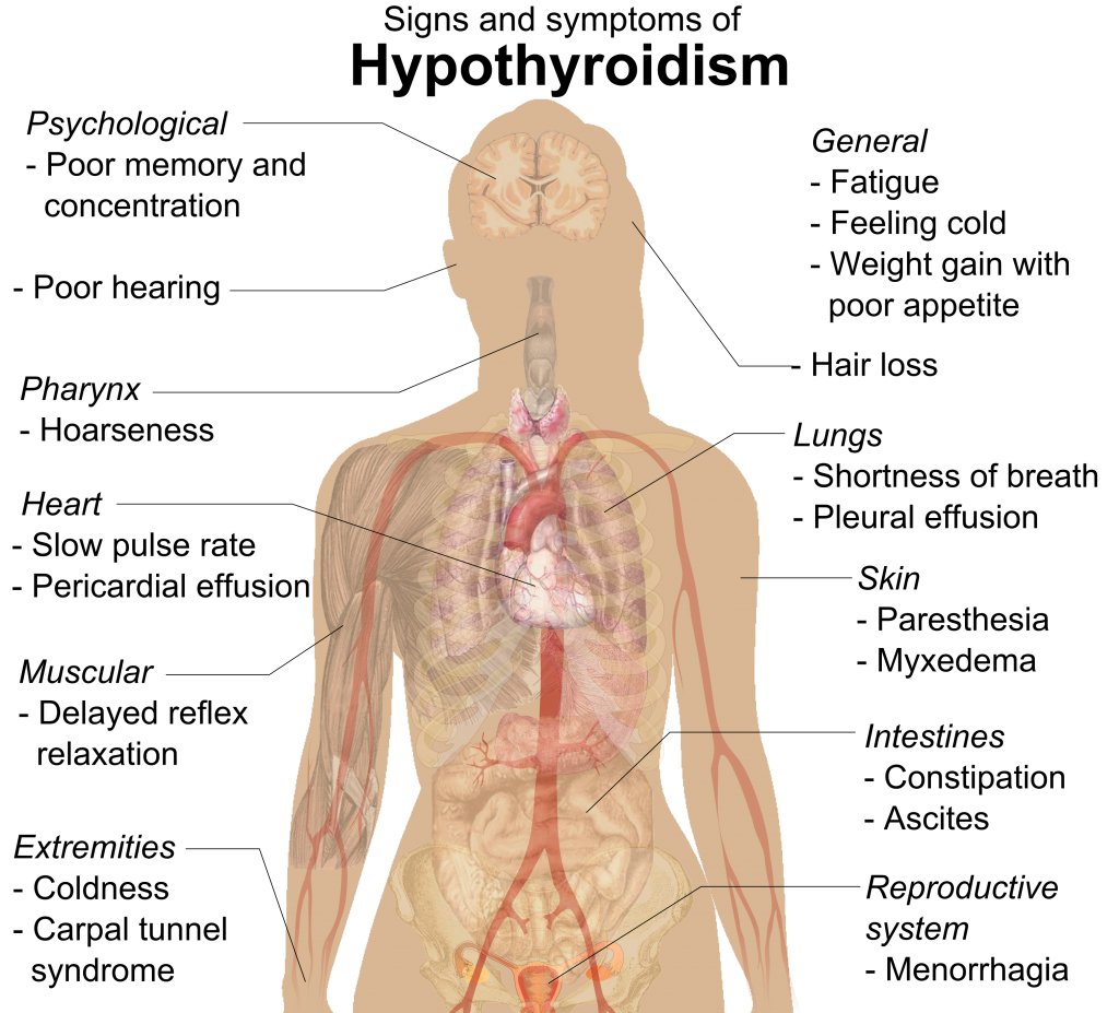 Hypothyroidism signs and symptoms