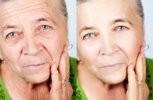 Collagen Skin Treatments